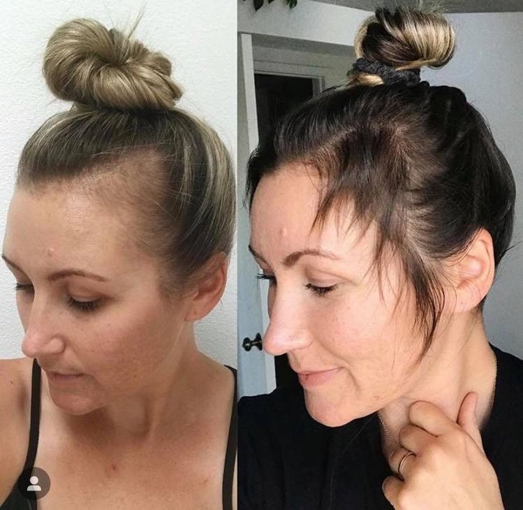 Lumeris Red Light Therapy Cap