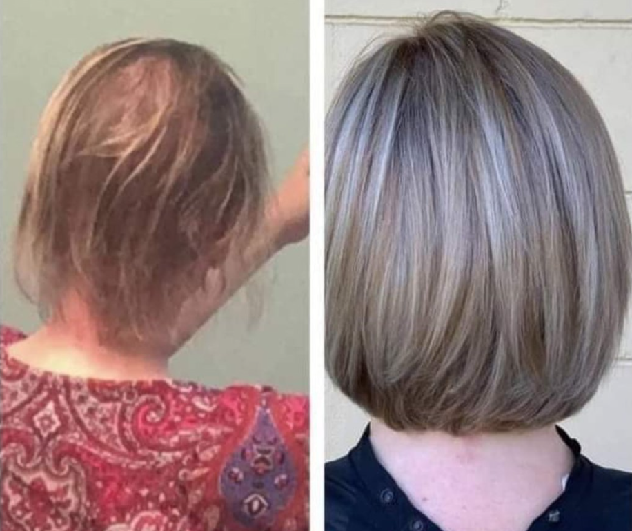 Lumeris Red Light Therapy Cap