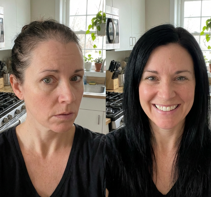 Lumeris Red Light Therapy Cap